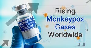 Rising Monkeypox Cases Worldwide: Vaccine Logistics